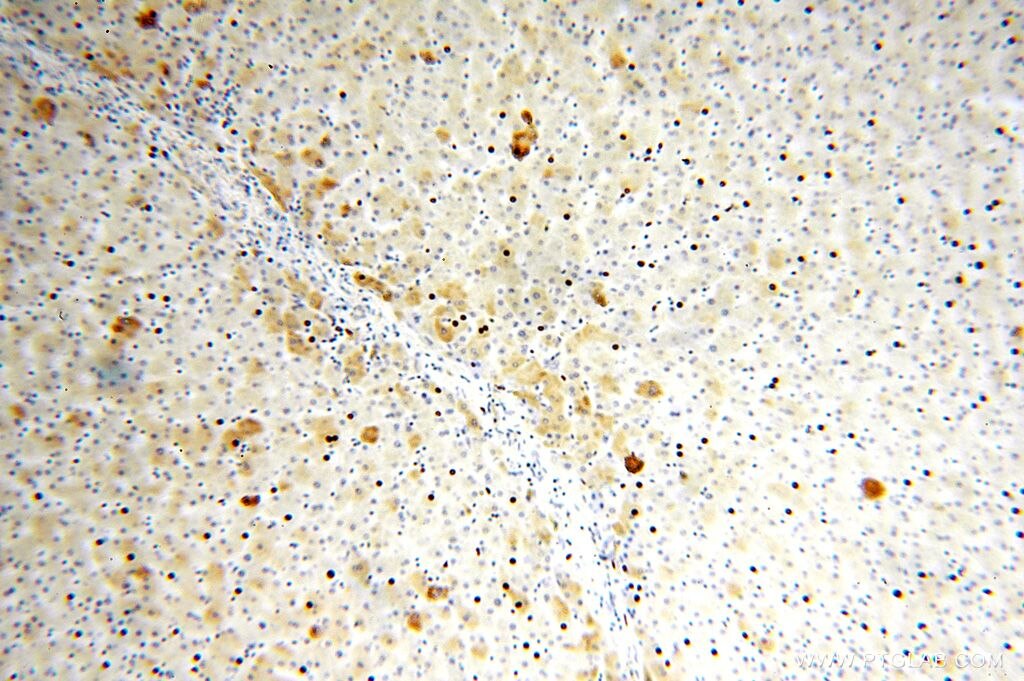 Immunohistochemistry (IHC) staining of human liver tissue using TRMT11 Polyclonal antibody (17555-1-AP)