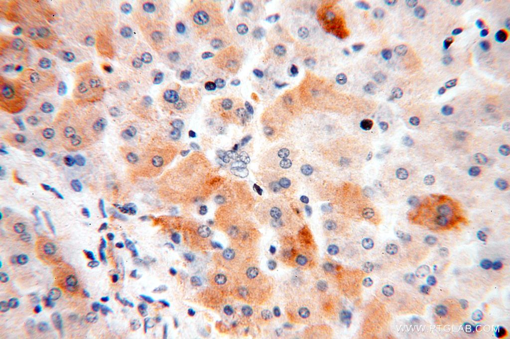 Immunohistochemistry (IHC) staining of human liver tissue using TRMT11 Polyclonal antibody (17555-1-AP)