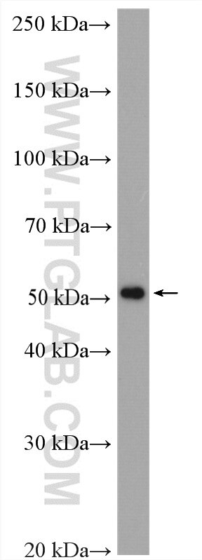 Western Blot (WB) analysis of LNCaP cells using TRMT11 Polyclonal antibody (17555-1-AP)