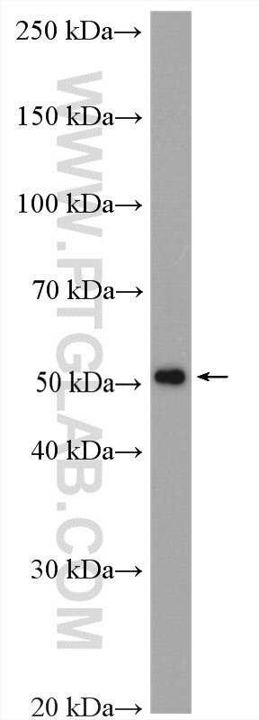 WB analysis of LNCaP using 17555-1-AP