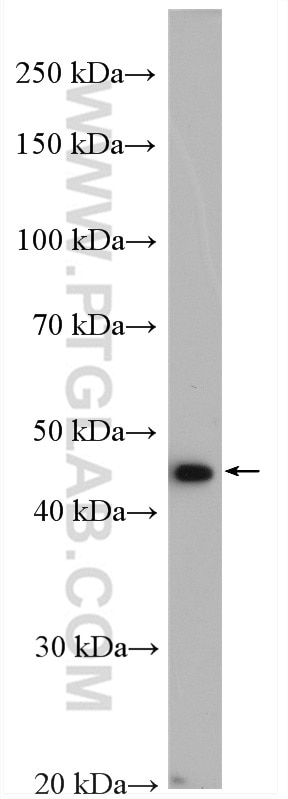 Western Blot (WB) analysis of K-562 cells using TRMT11 Polyclonal antibody (17555-1-AP)