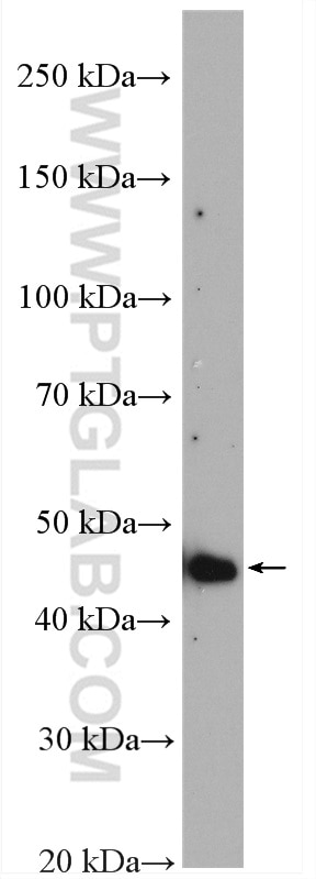 Western Blot (WB) analysis of mouse testis tissue using TRMT11 Polyclonal antibody (17555-1-AP)