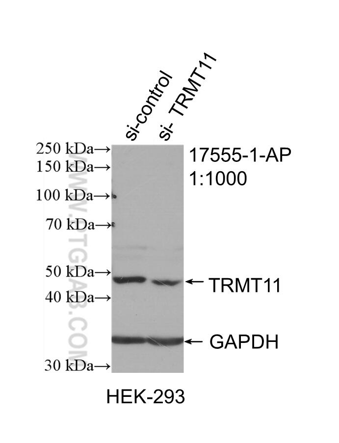 Western Blot (WB) analysis of HEK-293 cells using TRMT11 Polyclonal antibody (17555-1-AP)