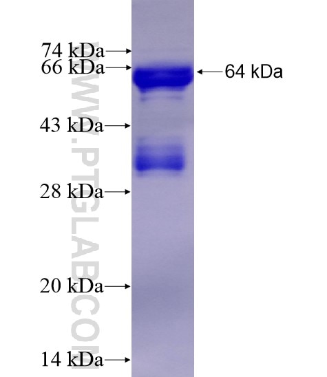 TRMT11 fusion protein Ag11717 SDS-PAGE