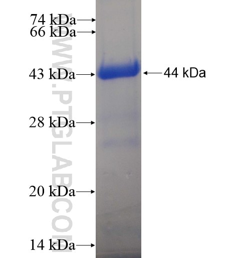 TRMT11 fusion protein Ag11873 SDS-PAGE