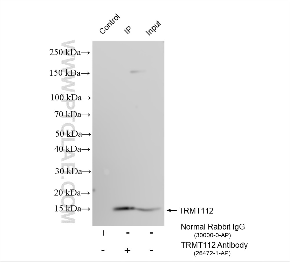 IP experiment of HEK-293 using 26472-1-AP Immunoprecipitation (IP) experiment of HEK-293 cells using TRMT112 Polyclonal antibody (26472-1-AP)