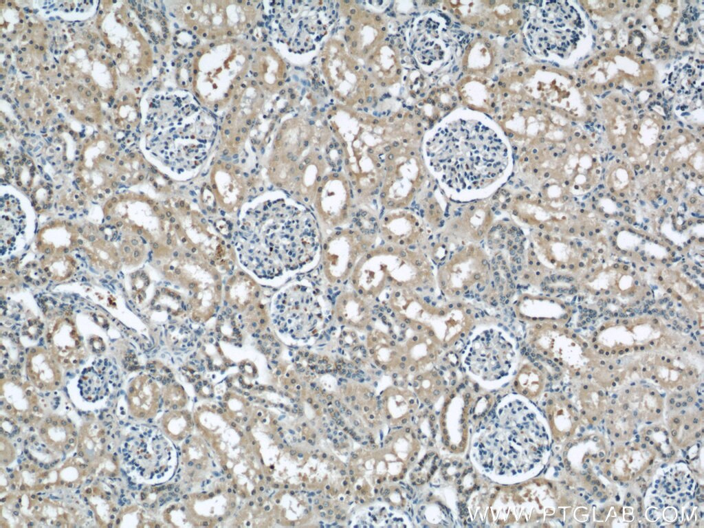 Immunohistochemistry (IHC) staining of human kidney tissue using HTF9C Polyclonal antibody (16199-1-AP)