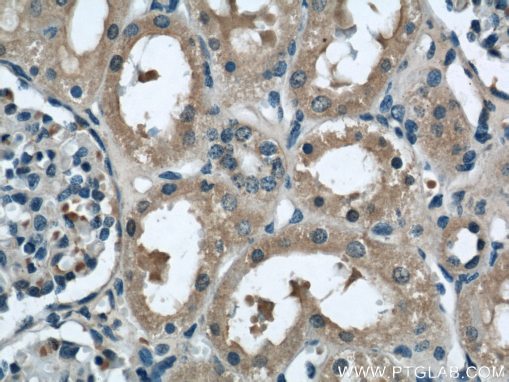 Immunohistochemistry (IHC) staining of human kidney tissue using HTF9C Polyclonal antibody (16199-1-AP)