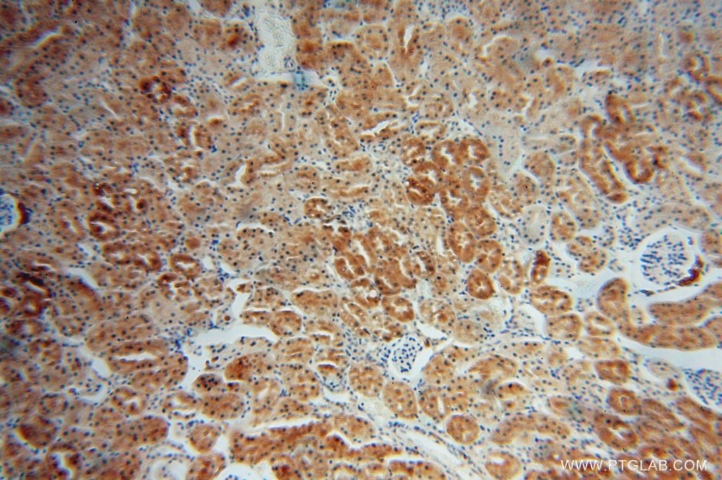 Immunohistochemistry (IHC) staining of human kidney tissue using HTF9C Polyclonal antibody (16199-1-AP)