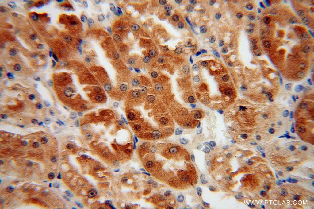Immunohistochemistry (IHC) staining of human kidney tissue using HTF9C Polyclonal antibody (16199-1-AP)