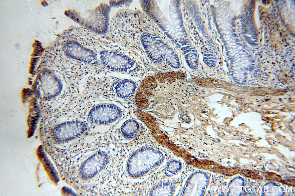 Immunohistochemistry (IHC) staining of human colon tissue using TRMT2B Polyclonal antibody (20767-1-AP)