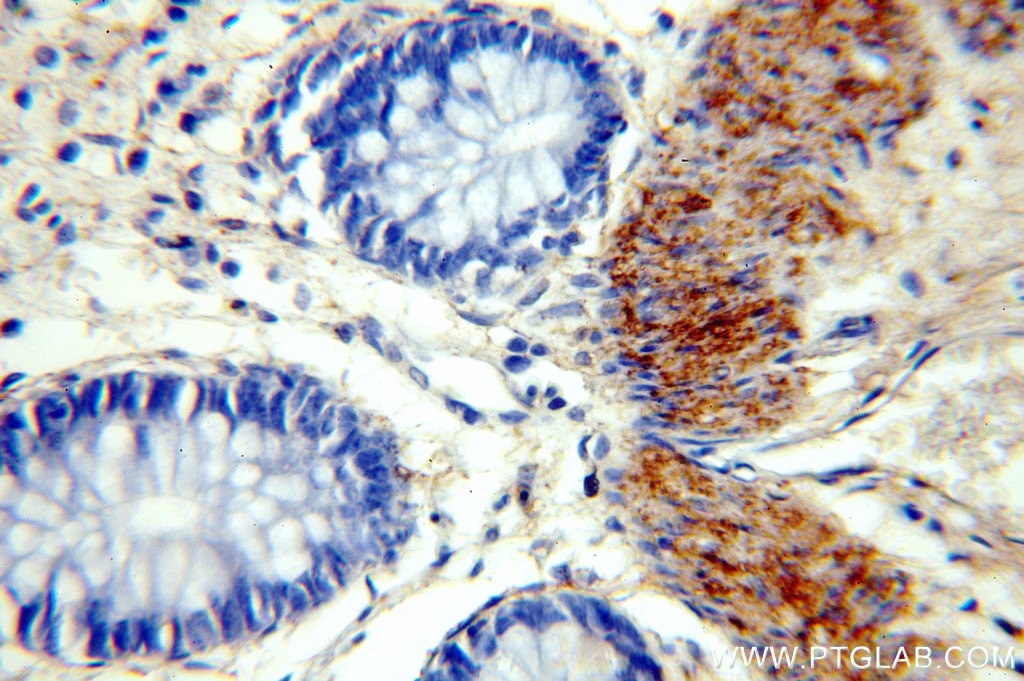 Immunohistochemistry (IHC) staining of human colon tissue using TRMT2B Polyclonal antibody (20767-1-AP)