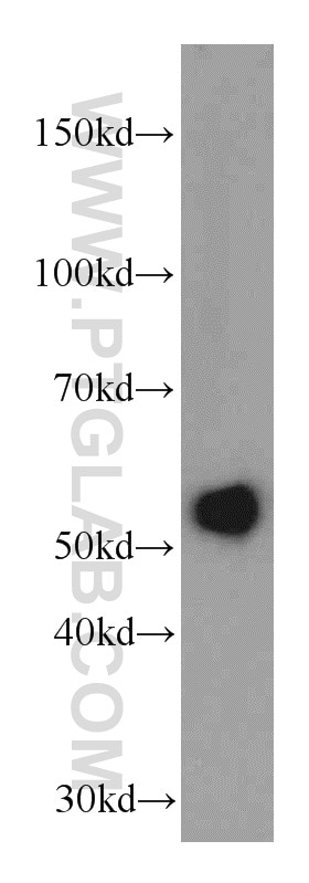 Western Blot (WB) analysis of HepG2 cells using TRMT2B Polyclonal antibody (20767-1-AP)
