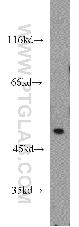 Western Blot (WB) analysis of HepG2 cells using TRMT2B Polyclonal antibody (20767-1-AP)