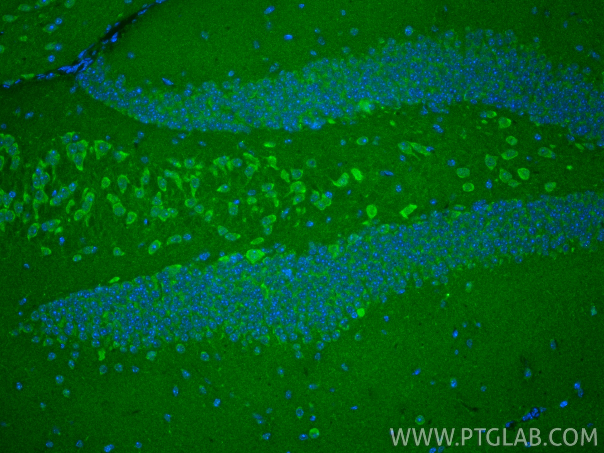 Immunofluorescence (IF) / fluorescent staining of mouse brain tissue using TRMT5 Polyclonal antibody (18255-1-AP)