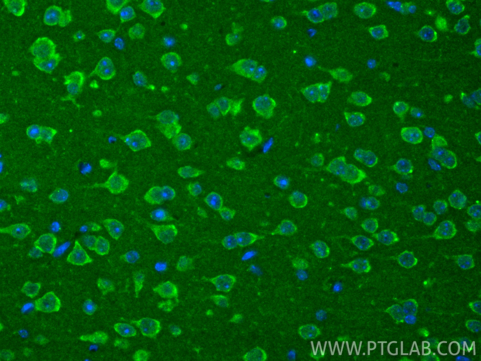 Immunofluorescence (IF) / fluorescent staining of mouse brain tissue using TRMT5 Polyclonal antibody (18255-1-AP)
