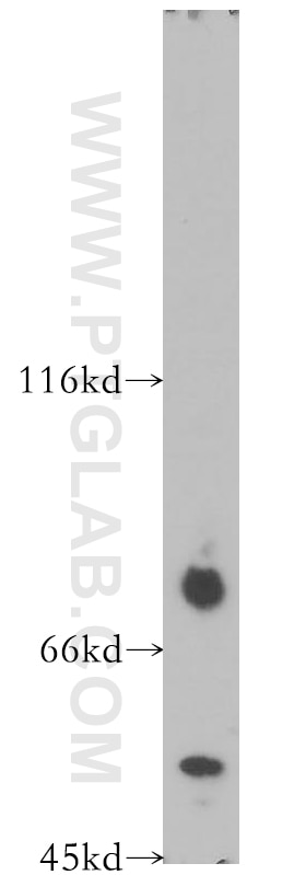 Western Blot (WB) analysis of NIH/3T3 cells using TRMT5 Polyclonal antibody (18255-1-AP)