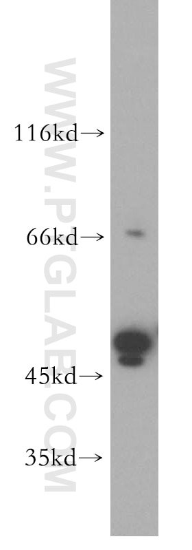 Western Blot (WB) analysis of Jurkat cells using TRMT5 Polyclonal antibody (18255-1-AP)