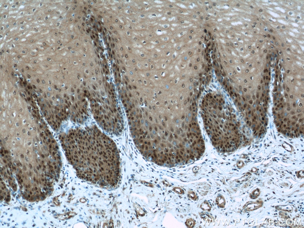 Immunohistochemistry (IHC) staining of human oesophagus tissue using TRMT6 Polyclonal antibody (16727-1-AP)