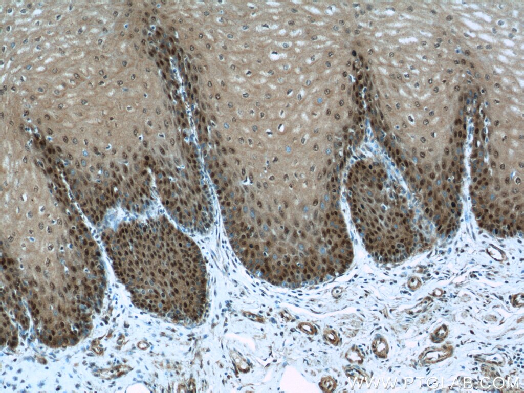 IHC staining of human oesophagus using 16727-1-AP