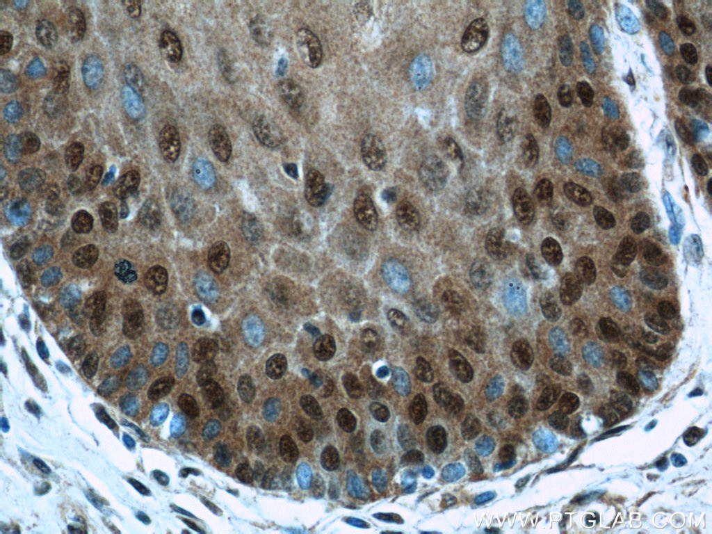 IHC staining of human oesophagus using 16727-1-AP