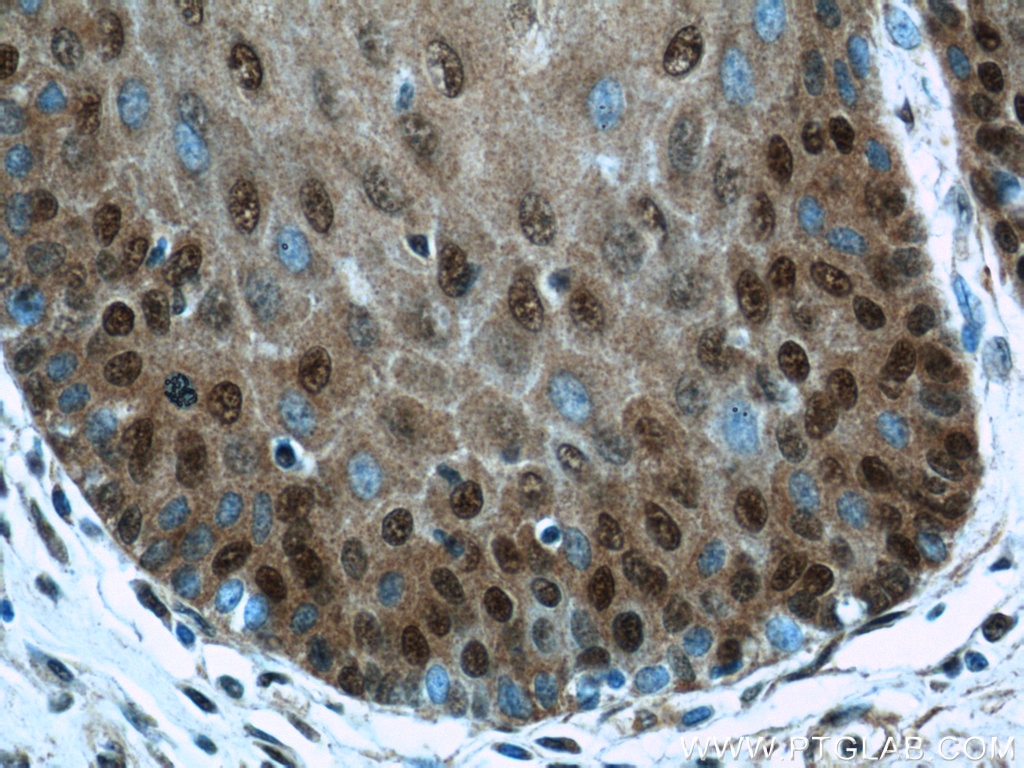 Immunohistochemistry (IHC) staining of human oesophagus tissue using TRMT6 Polyclonal antibody (16727-1-AP)