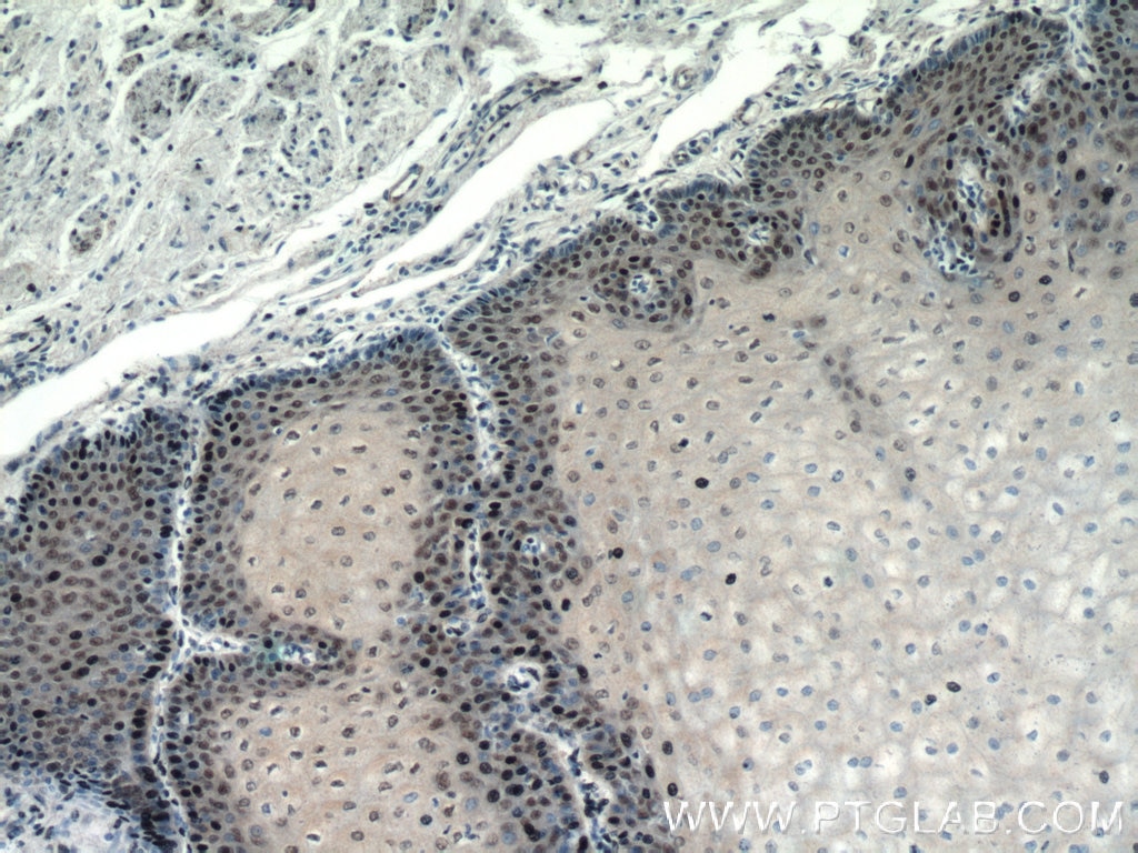 Immunohistochemistry (IHC) staining of human oesophagus tissue using TRMT6 Polyclonal antibody (16727-1-AP)