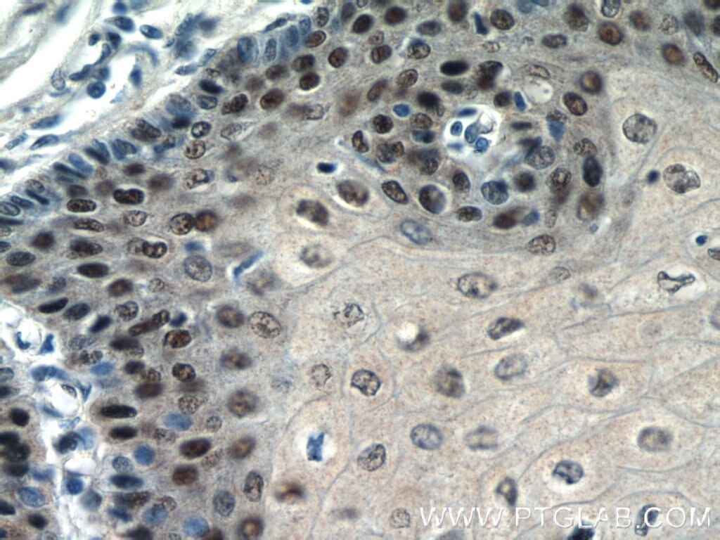 Immunohistochemistry (IHC) staining of human oesophagus tissue using TRMT6 Polyclonal antibody (16727-1-AP)