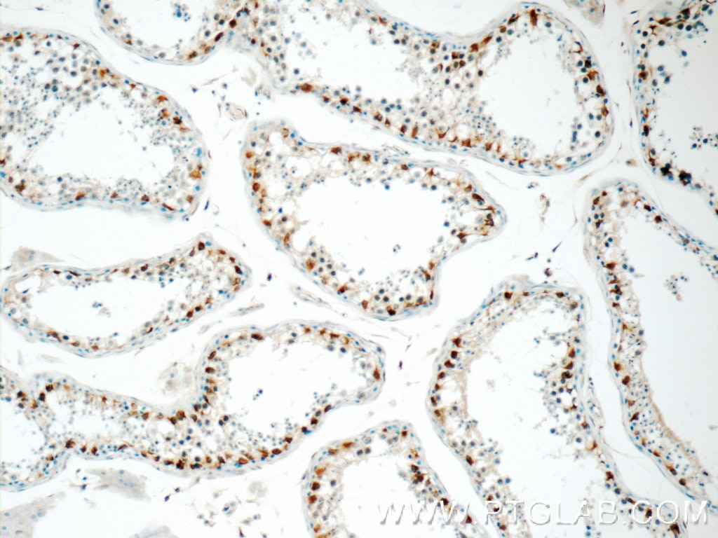 Immunohistochemistry (IHC) staining of human testis tissue using TRMT6 Polyclonal antibody (16727-1-AP)