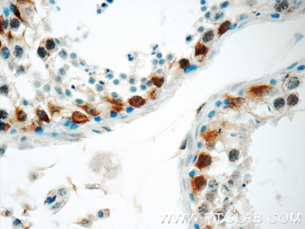 Immunohistochemistry (IHC) staining of human testis tissue using TRMT6 Polyclonal antibody (16727-1-AP)