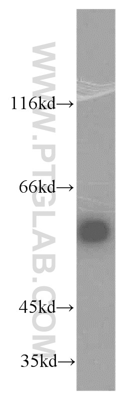 Western Blot (WB) analysis of mouse ovary tissue using TRMT6 Polyclonal antibody (16727-1-AP)