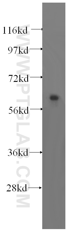 Western Blot (WB) analysis of human brain tissue using TRMT6 Polyclonal antibody (16727-1-AP)