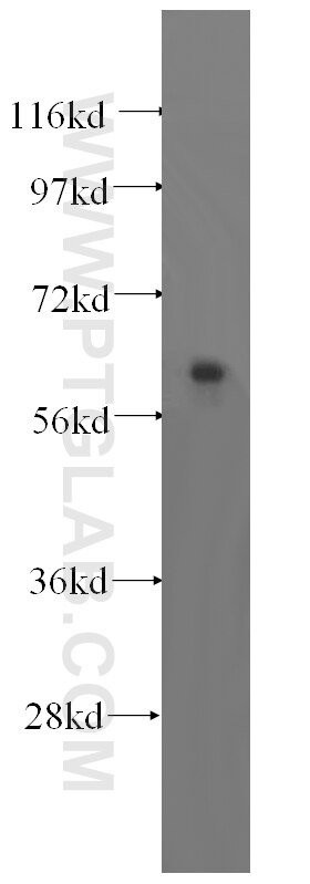 WB analysis of human brain using 16727-1-AP