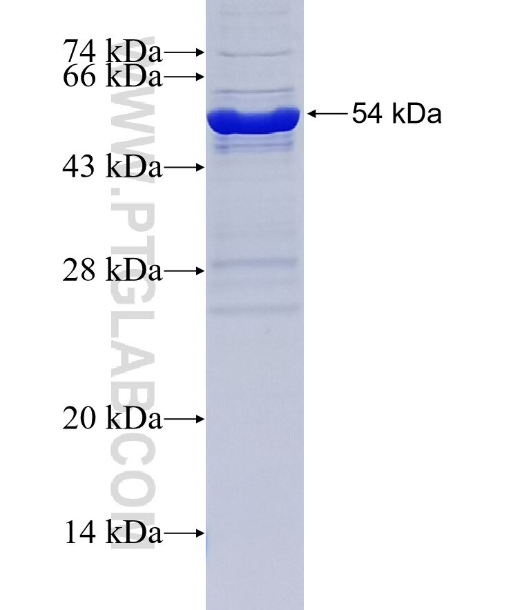 TRMT61A fusion protein Ag34396 SDS-PAGE