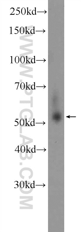 Western Blot (WB) analysis of HeLa cells using TRMT61B Polyclonal antibody (26009-1-AP)