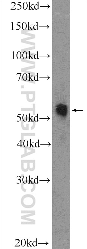 Western Blot (WB) analysis of HepG2 cells using TRMT61B Polyclonal antibody (26009-1-AP)