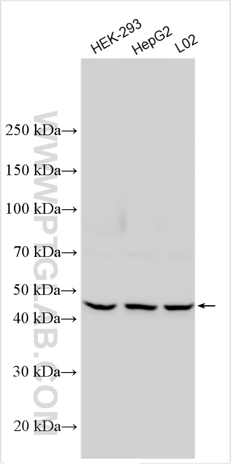 Western Blot (WB) analysis of various lysates using TRMT9B Polyclonal antibody (32716-1-AP)