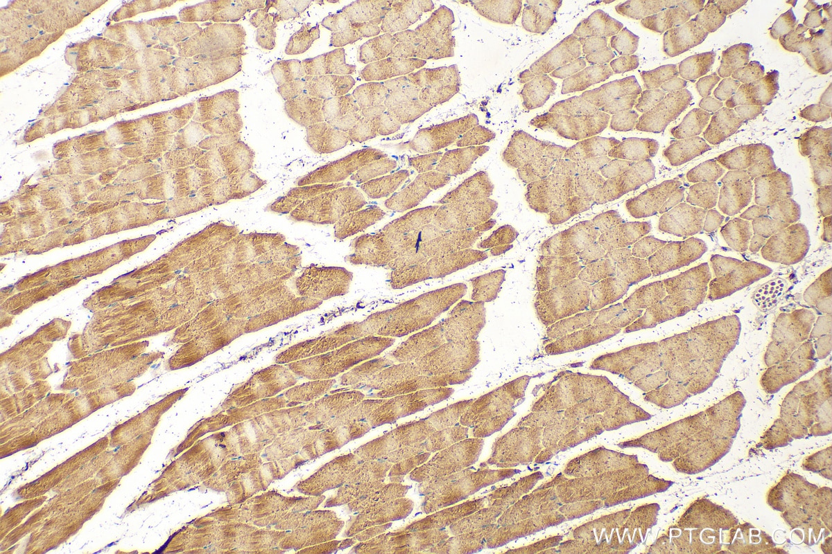 Immunohistochemistry (IHC) staining of mouse skeletal muscle tissue using TRNT1 Polyclonal antibody (25376-1-AP)