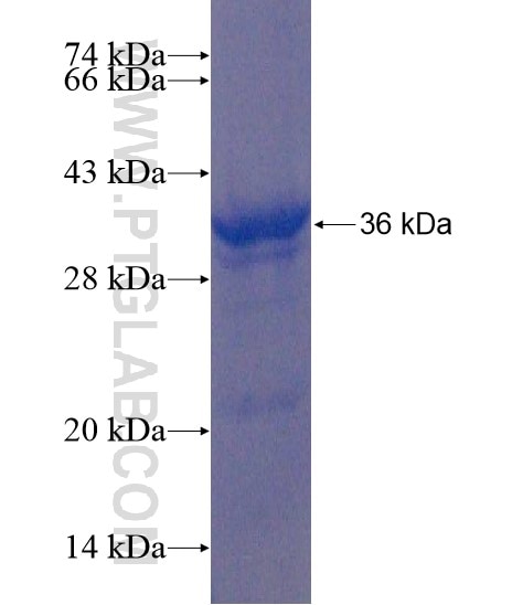 TRMU fusion protein Ag21957 SDS-PAGE