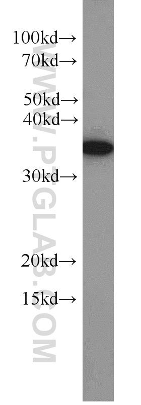 Western Blot (WB) analysis of Jurkat cells using TRNAU1AP,SECP43 Polyclonal antibody (15053-1-AP)