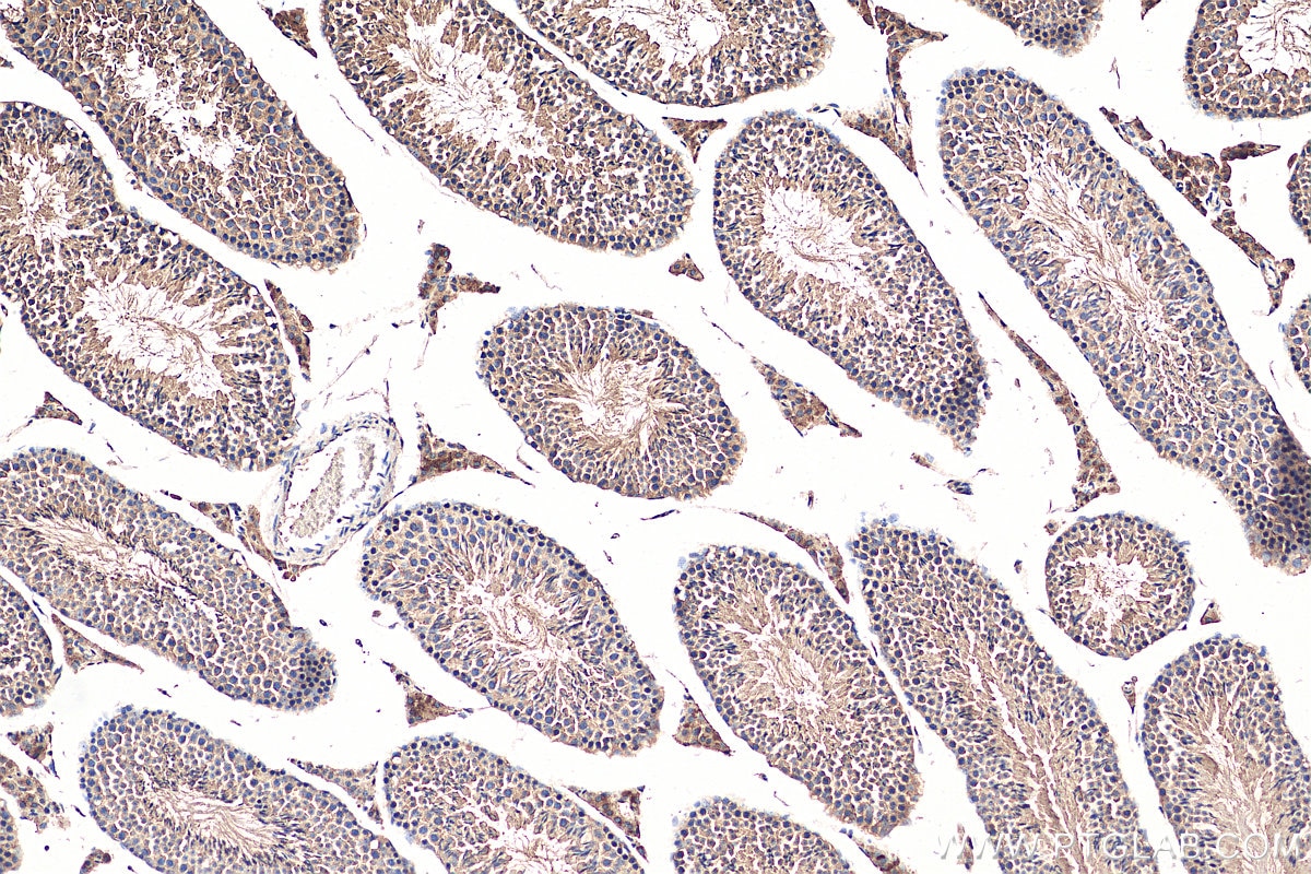 IHC staining of mouse testis using 13634-1-AP