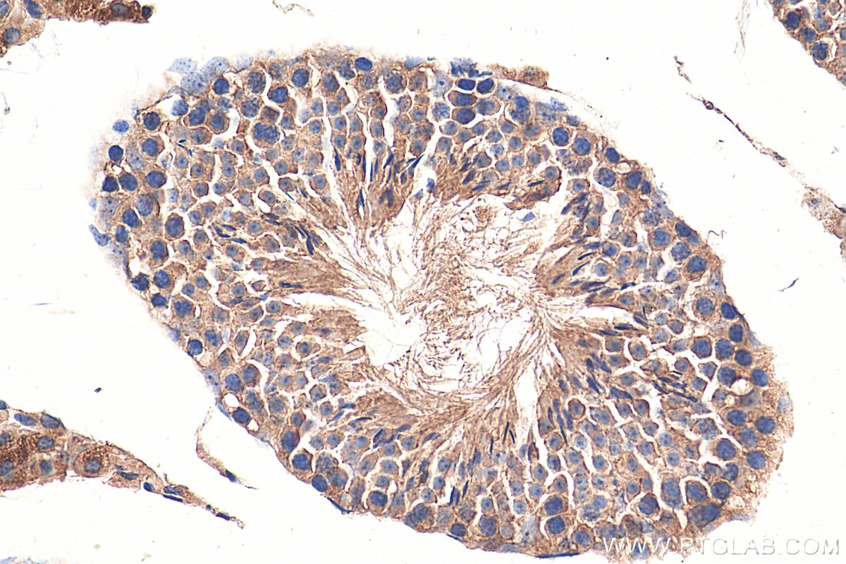 Immunohistochemistry (IHC) staining of mouse testis tissue using TROAP Polyclonal antibody (13634-1-AP)