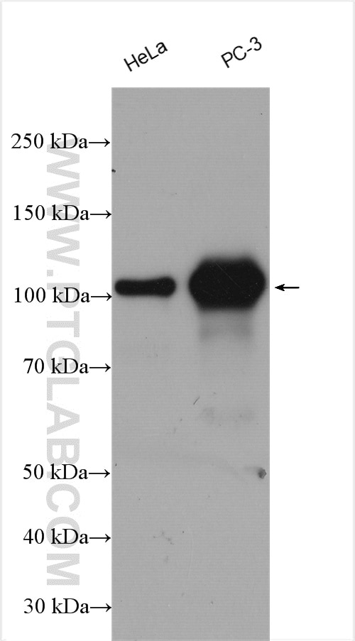 Western Blot (WB) analysis of various lysates using TROAP Polyclonal antibody (13634-1-AP)