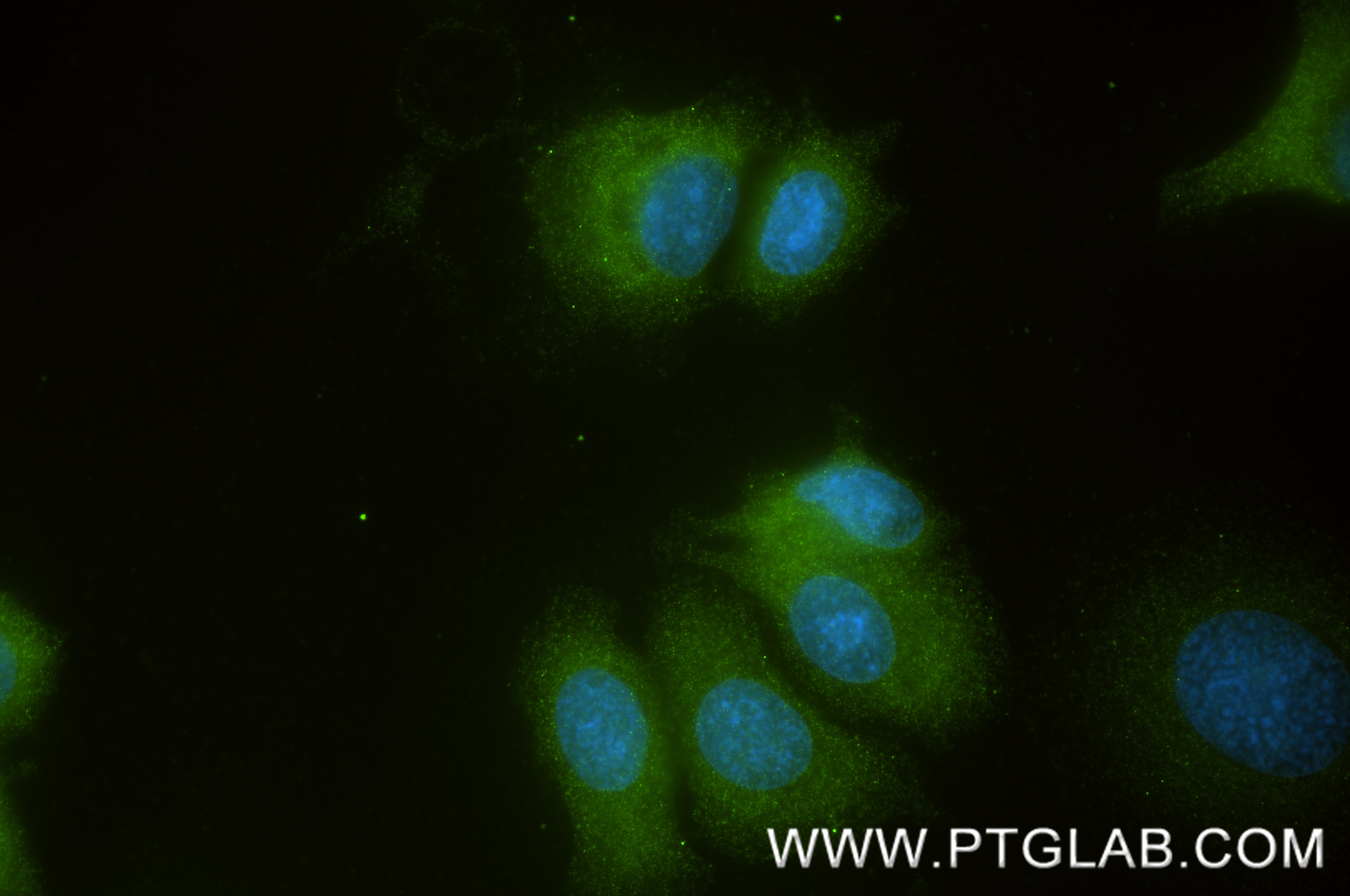 Immunofluorescence (IF) / fluorescent staining of SK-BR-3 cells using TROAP Recombinant monoclonal antibody (86735-2-RR)