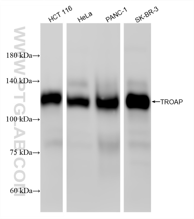 Western Blot (WB) analysis of various lysates using TROAP Recombinant monoclonal antibody (86735-2-RR)