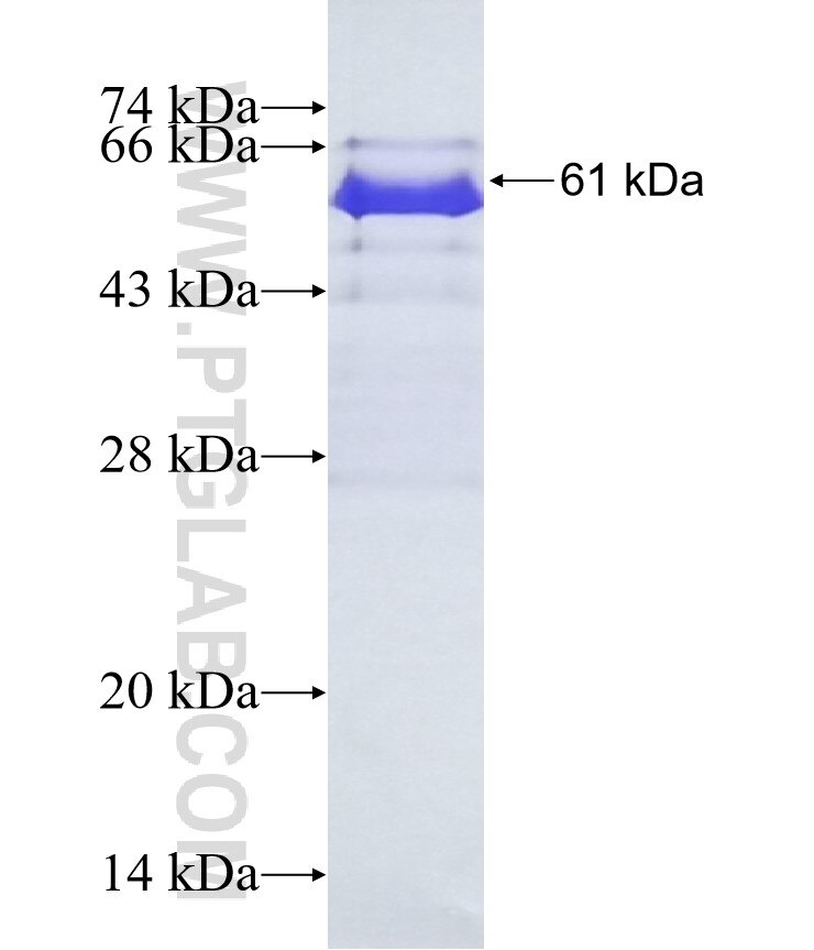 TROAP fusion protein Ag4562 SDS-PAGE