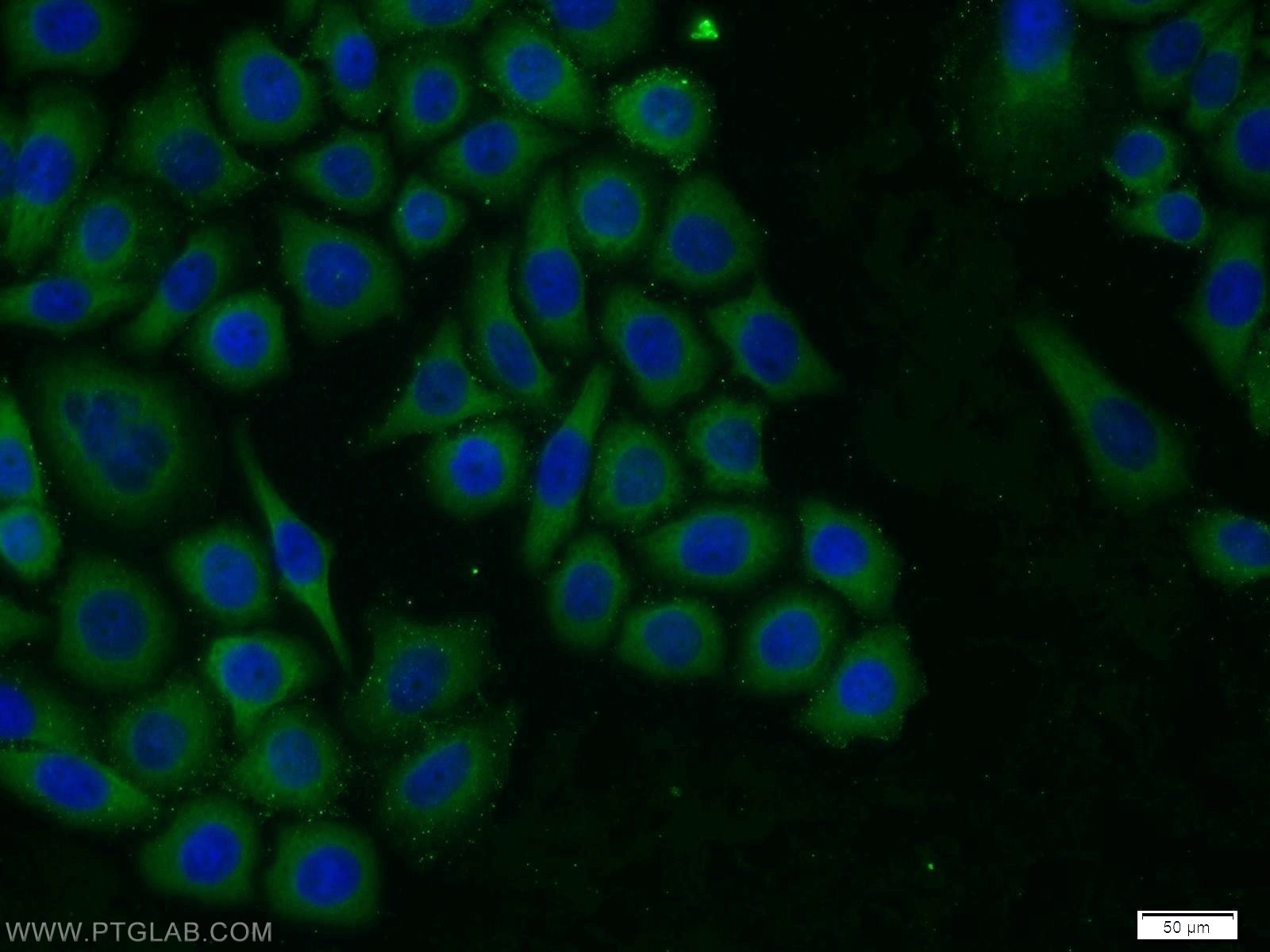 Immunofluorescence (IF) / fluorescent staining of PC-3 cells using TROVE2 Polyclonal antibody (12718-1-AP)
