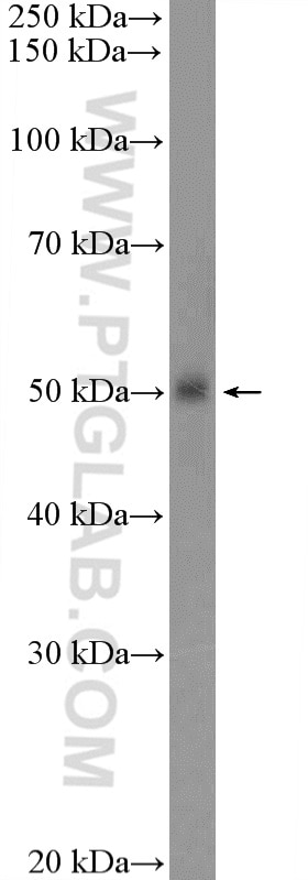 Western Blot (WB) analysis of rat spleen tissue using TROVE2 Polyclonal antibody (12718-1-AP)