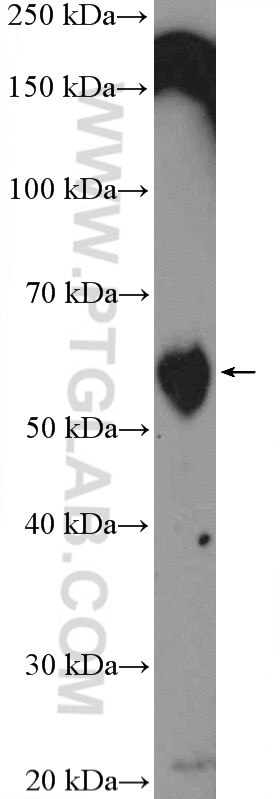 Western Blot (WB) analysis of mouse thymus tissue using TROVE2 Polyclonal antibody (12718-1-AP)