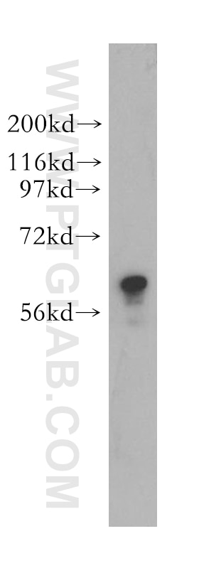 Western Blot (WB) analysis of MCF-7 cells using TROVE2 Polyclonal antibody (12718-1-AP)